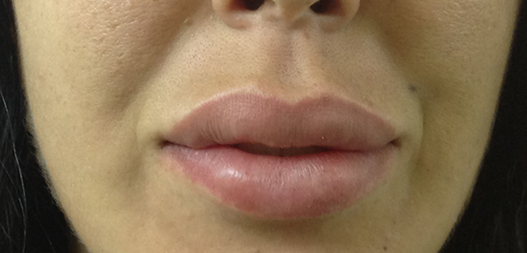 Après les lèvres