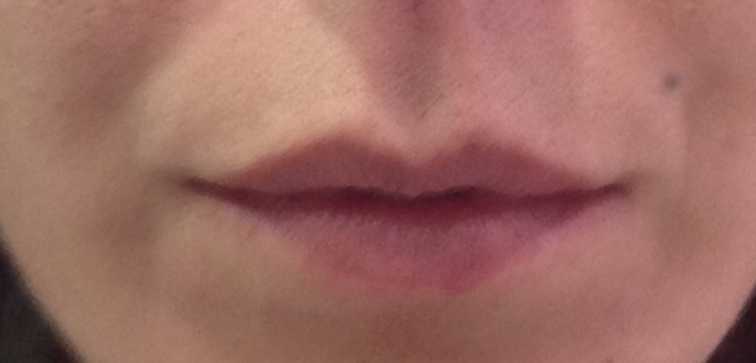 Before-Lips